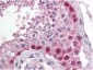 Anti-Cul4A (N-terminal specific) (RABBIT) Antibody